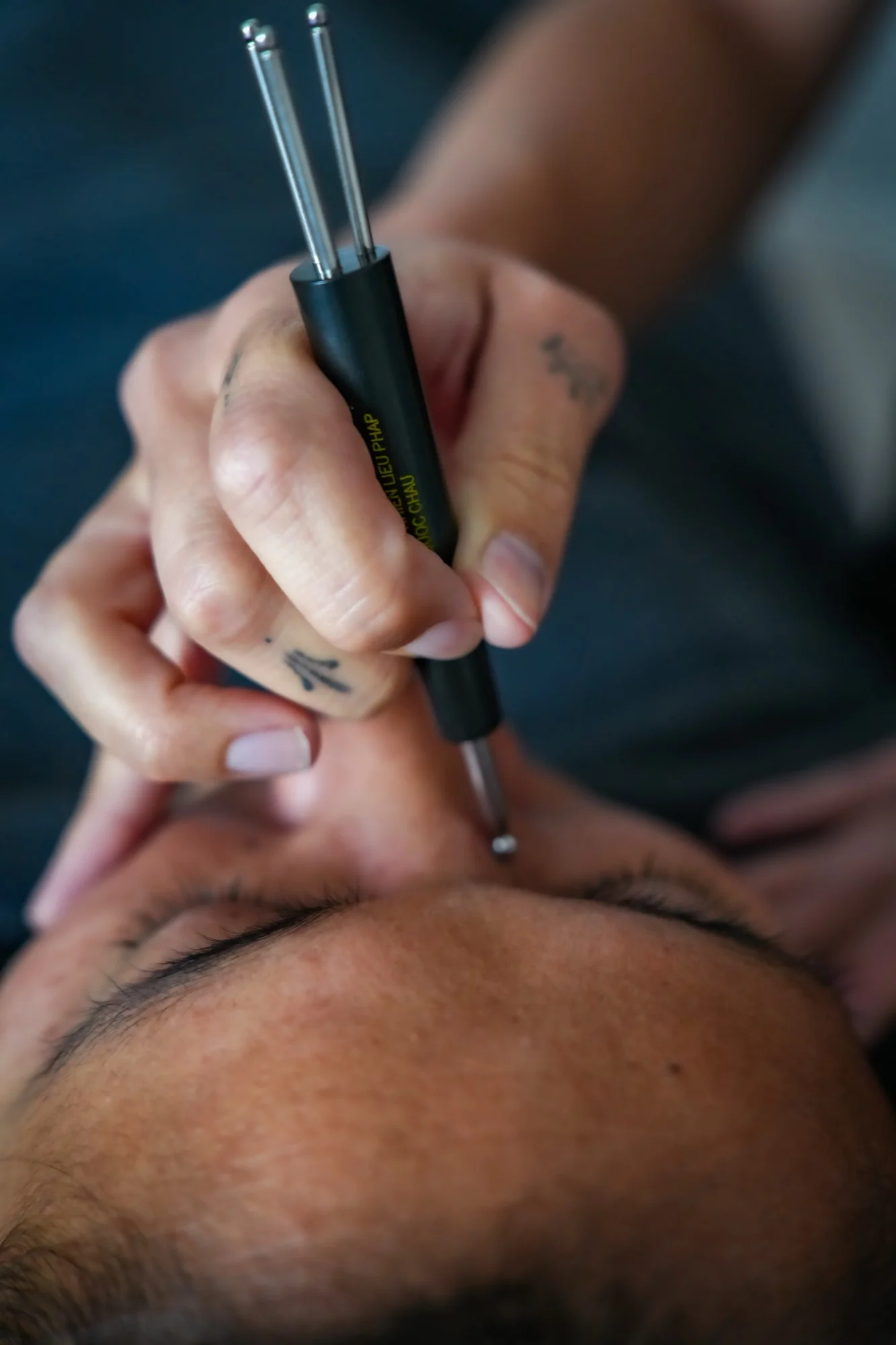 Outil Dien Chan à double sonde utilisé sur le visage